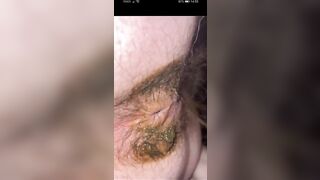 Amazing closeup poop