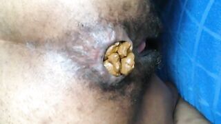 Ebony hairy asshole poops