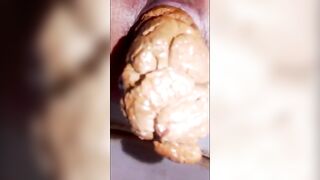 Rectum and poop closeup