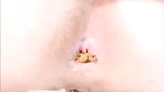 Pinkish pooping asshole