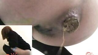 Dirty hairy Asian girl poop and piss