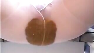 Diarrhea in pantyhose