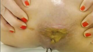 Yellow sticky poop in bathtub