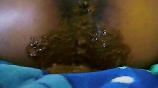 Nasty Black Poop