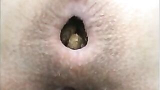 Closeup of sexy pooping asshole