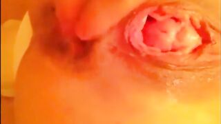 Anal self fisting prolapsed with little shit at home