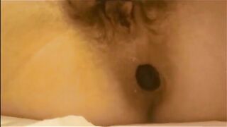 Hairy cunt milf shitting a load of diarrhea