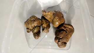 Hard poop in a clear plastic box