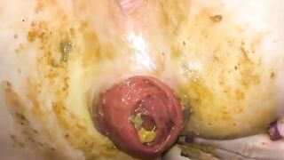 Closeup of thick and pooping asshole