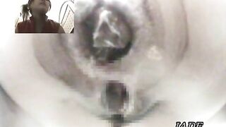 kinky pooping asshole closeup