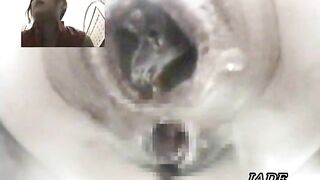 kinky pooping asshole closeup