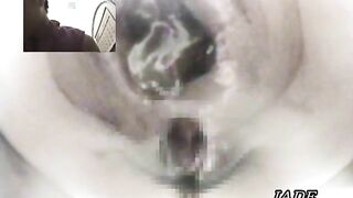 kinky pooping asshole closeup