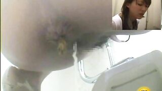 Tampon and hard poop