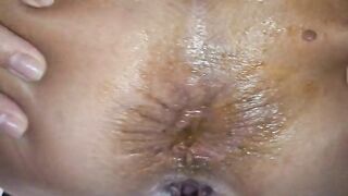 Cheeky asshole winking and pooping