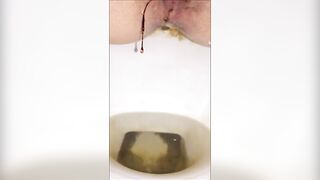 Girl on her period shit and piss